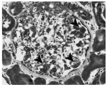 Световая микроскопия нефробиоптата (краситель Ниссля, ×400).