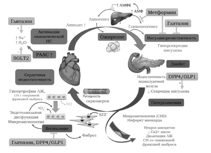 При сердечной недостаточности нейроэндокринная активация изменяет гемодинамику и метаболизм и предрасполагает к развитию СД через резистентность к инсулину [3].