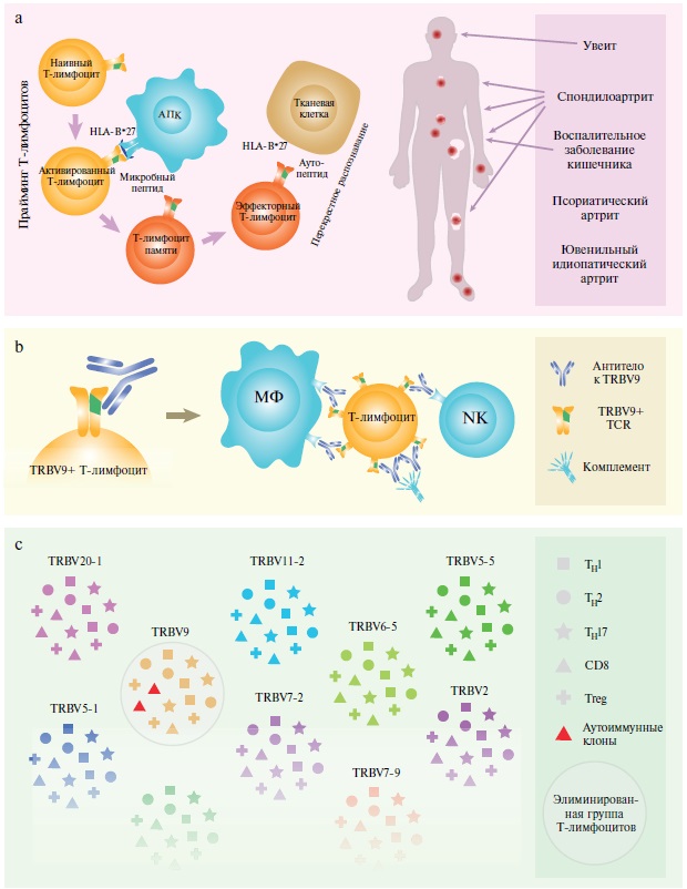 HLA-B*27-ассоциированные спондилоартриты, а также механизм действия и эффекты анти-TRBV9-иммунотерапии. a. Концепция артритогенного пептида. CD8+ Т-лимфоциты, праймированные микробными пептидами, презентированными HLA-B*27, образуют популяции Т-клеток памяти, которые затем в результате перекрестной реактивности взаимодействуют с собственными пептидами, связанными с HLA-B*27 [22]. В зависимости от хоуминга Т-лимфоцитов и других факторов формируется клиническая картина HLA-B*27-ассоциированного спондилоартрита, характерная для этого аутоиммунного заболевания. b. Терапия цитотоксическими антителами к TRBV9 приводит к полной элиминации TRBV9+ Т-лимфоцитов посредством нескольких механизмов: антителозависимой клеточной цитотоксичности, осуществляемой естественными киллерными клетками (NK), белками комплемента, а также антителозависимого клеточного фагоцитоза макрофагами (MΦ), такими как купферовские клетки печени [23]. c. Анти-TRBV9-терапия направлена на уничтожение клонов TRBV9+ Т-лимфоцитов, в том числе аутоиммунных, но не приводит к системным изменениям ни одной из ветвей Т-клеточного иммунитета. Показаны только наиболее частые сегменты гена TRBV